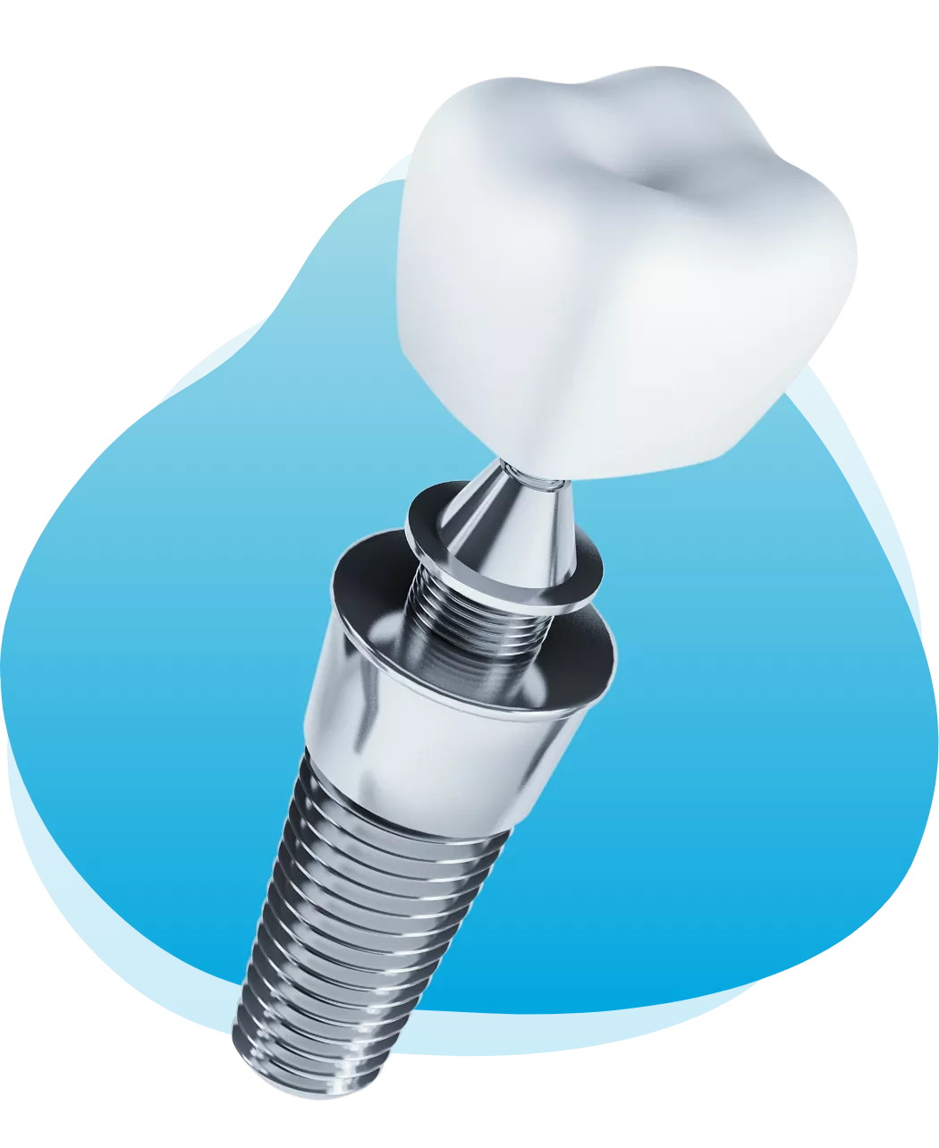 single dental implant image